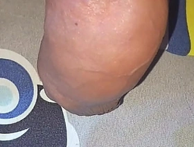 Myanmar gay Cocklovermlm  homemade saline injection